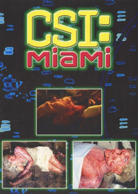 CSI: Miami: Slow Burn FYC