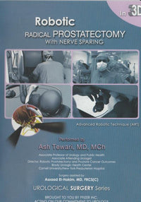 Robotic Radical Prostatectomy With Nerve Sparing w/ 3D Glasses