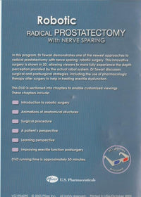 Robotic Radical Prostatectomy With Nerve Sparing w/ 3D Glasses