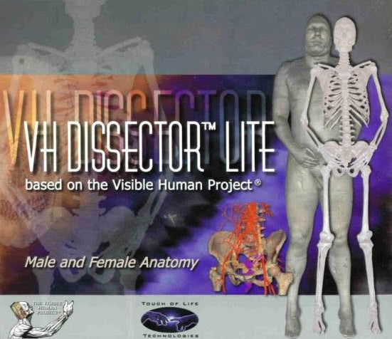 VH Dissector 4 Lite